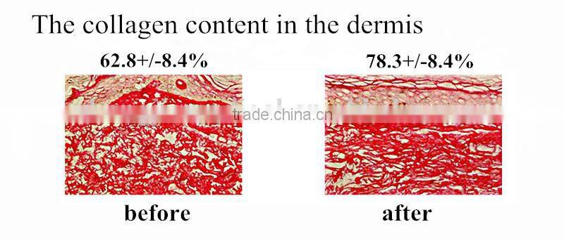 LED Product Professional OEM Service for beauty salon equipment with factory price