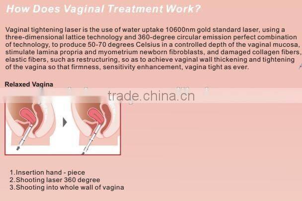 High power medical CO2 laser/ fractional CO2 laser/ CO2 fractional laser device