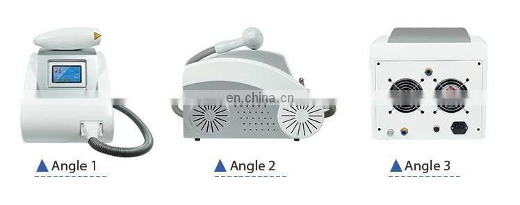 Our company want distributor! Factory direct sale nd yag laser q switch tattoo removal laser