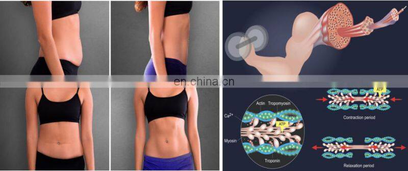 Muscle Stimulator Body Building EMS RF Machine with 4 Handles