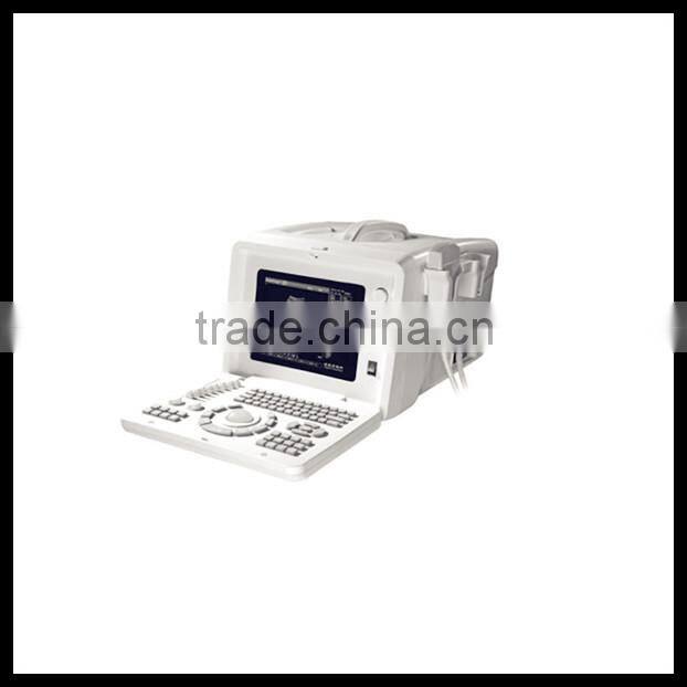(Pregnant week,fetal weight,volume.etc) Both use in human and animal new portable laptop ultrasound machine/scanner/system price