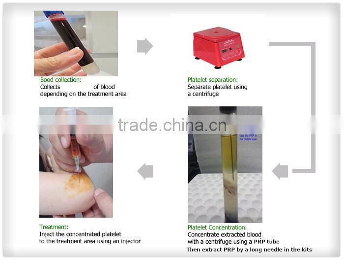 Small size PRP centrifuge DD4-M