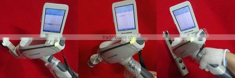 Stainless steel stair baluster