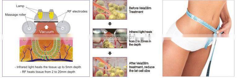 portable professional bipolar RF radio frequency tool skin lifting beauty facial equipment for home use