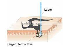 hotest soon spa laser aesthetic apparatus