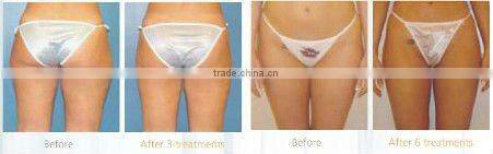 2012 CAVITATION VAC for Body Shaping & CE