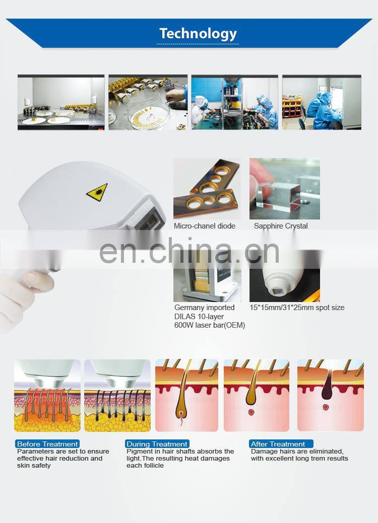 808nm diode laser hair removal Germany, permanent hair removal by laser