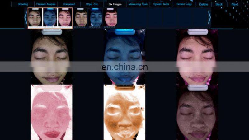 Sales 2022 Hot seal magic mirror facial UV Mositure tester Grease Wrinkle skin analyzer