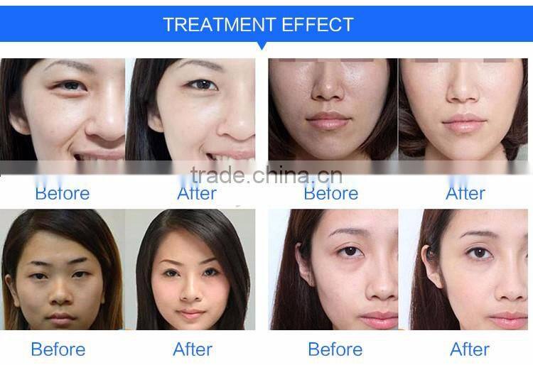 3 in 1 Multifunctional Skin Whitening Facial Spray RF Beauty Machine for Home Use Equipment