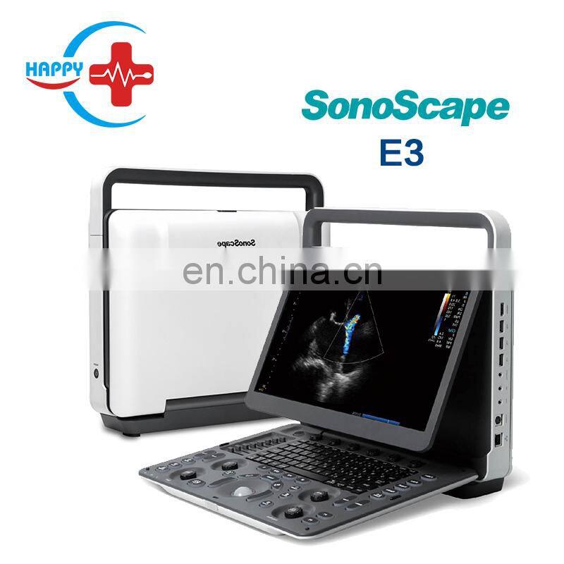 Hot Sale Sonoscape E3 Portable 15 Inch LCD Laptop Ultrasound Device Color Doppler Ultrasound Machine