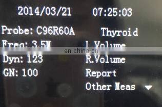 HC-A003 Cheap Full digital laptop veterinary ultrasound scanner machine