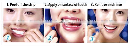 Bright Smile Teeth Whitening Strips-30 min Express