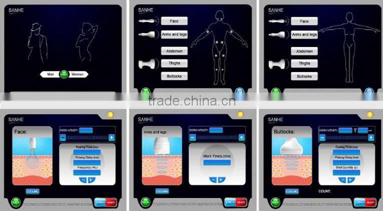 distributor wanted!!Sanhe New Products hifu machine 33mm-63mm fat reduce hifushape hifu slimming fat reduce machine