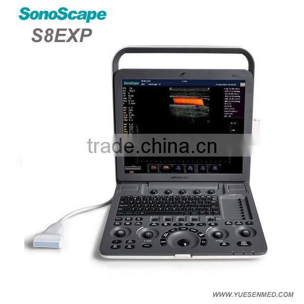 Medical device Color Doppler Portable 4d ultrasound