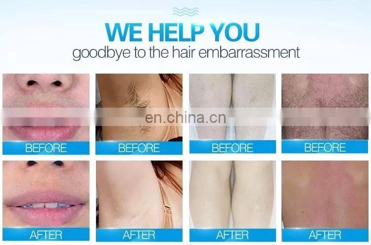 Professional Beauty Machine /2018 CE approval 808 Diode laser hair removal / 808nm Diode laser