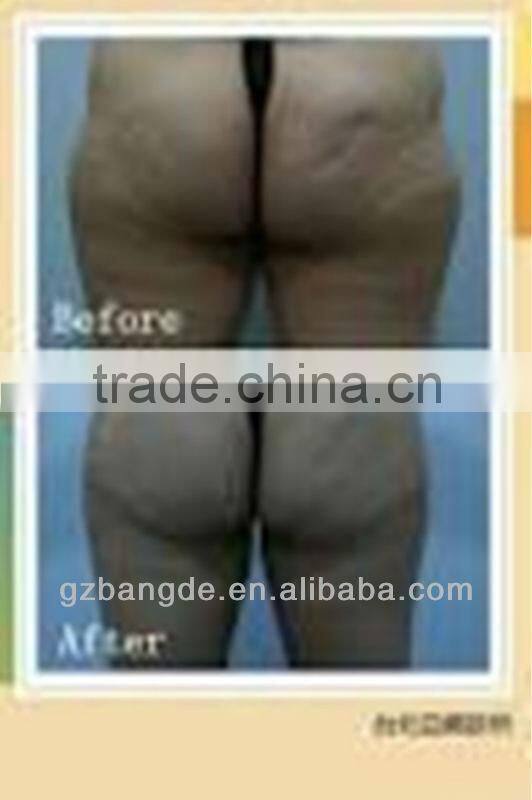 Face Massager Machine For Skin Tightening and Anti-aging BD-SP003