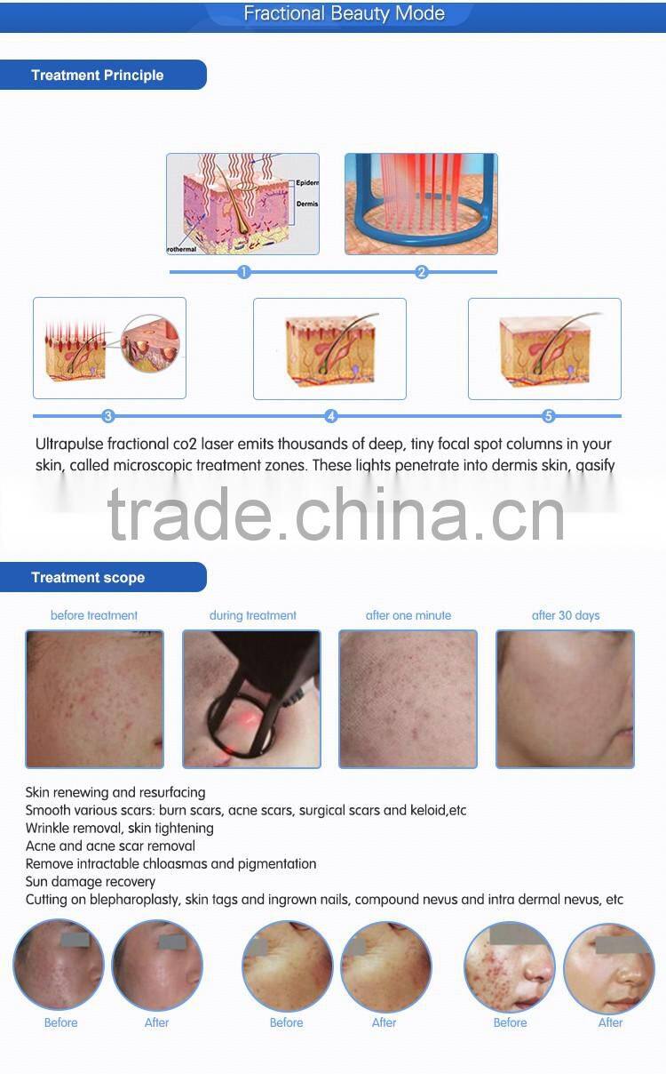 Hottest skin resurfacing vaginal tightening laser/fractional co2 laser cutting machine