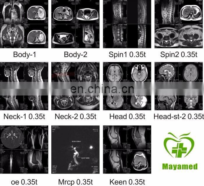 Hospital Medical 0.3T MRI scanner/scan/machine equipment price with mri film for sale