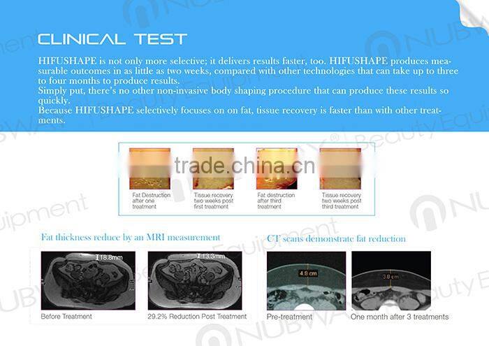 CE approved HIFU slimming machine / cavitation focus slimming machine / HIFU beauty machine