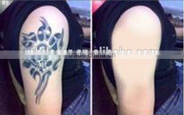 home use Q switch nd yag laser tattoo removal machine