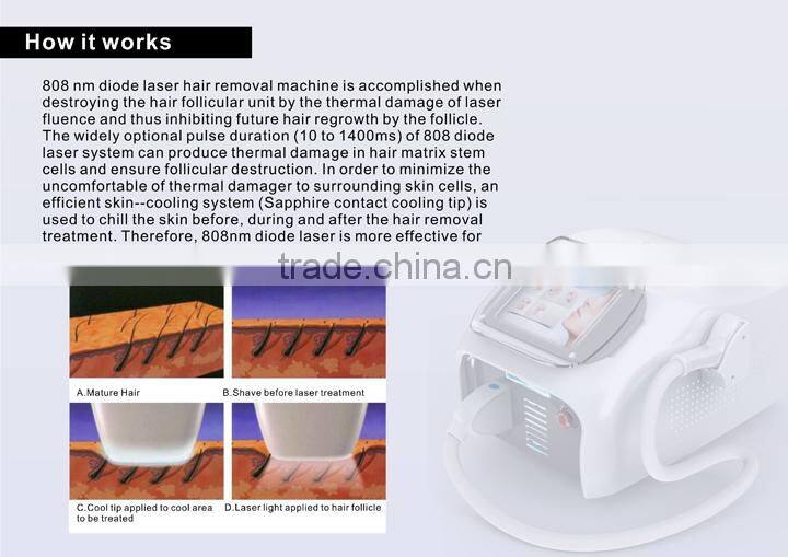 Big Power Portable Laser Diode 808nm /808 Diode Laser Hair Removal /portable diode laser hair removal with factory price