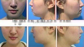 New style hotsell mini home ipl hair removal machine