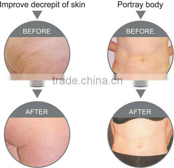 2013 Professional Cavitation+RF Weight Loss Machine