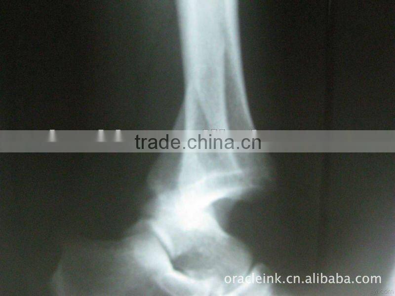 Manufacturer of films,medical dry imaging film with CE,konida x ray film,fit for with fuji and agfa printers