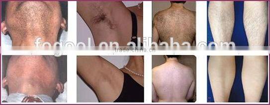 Home Use IPL Permanent freckle Removal Machine, Rejuvenation, Acne Device,mini home ipl