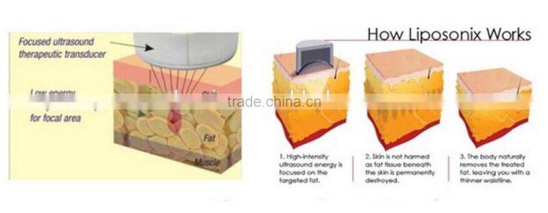 LS08-laura Promotion HIFU Body Slimming machine