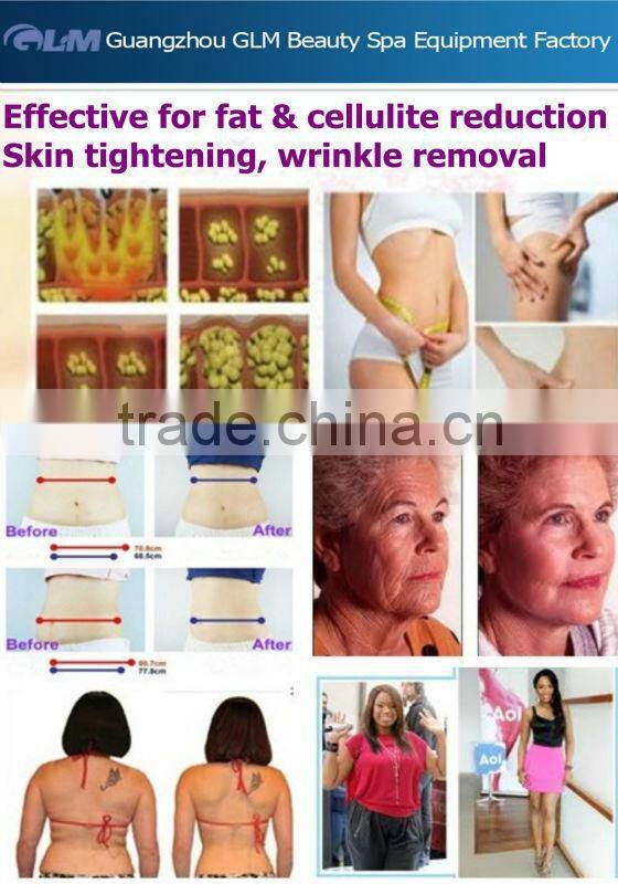 GLM-Hot Sale! Effective rf vacuum roller system machine/roller and vacuum slimming machine