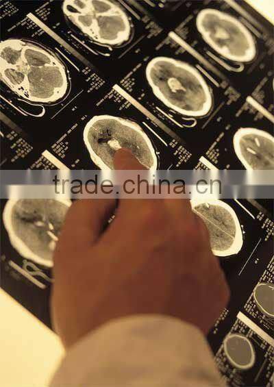 dry thermal film,dry x-ray film, dry imaging film