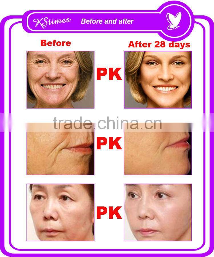 Korean formula Keep young anti-aging wrinkle removal home use anti aging machine