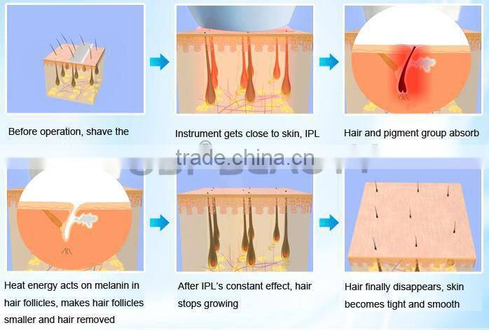 (OD-Mini70) Distributors wanted!! CE approval beauty machine hair removal ipl system