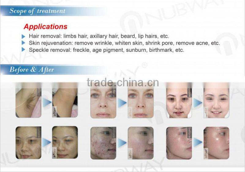 Hottest Promotion! Multifunctional SHR IPL Hair Removal and Skin Care Medical Device