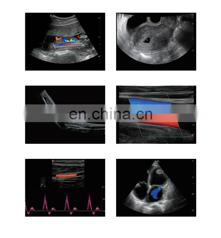 Professional 4D Color Doppler Sonoscape ultrasound scanner/Portable Sonoscape S8 EXP/Sonoscape ultrasound