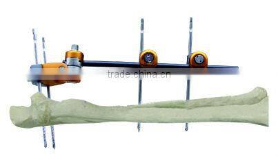 Proximal Ulna Radius Fractures orthopedic external fixation