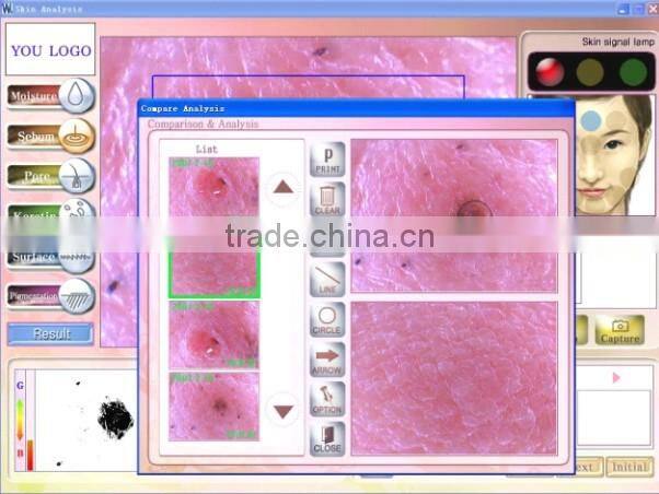 Magic mirror skin analyzer Skin scope analyzer