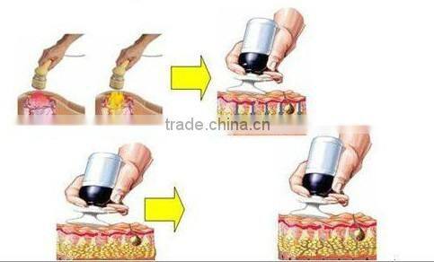 fat cavitation slimming equipment/fast cavitation slimming system/cavitation slimming machine