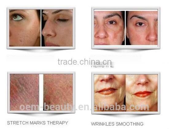 wholesale manufacturer Yyr newest comprehensive device zgts derma roller system