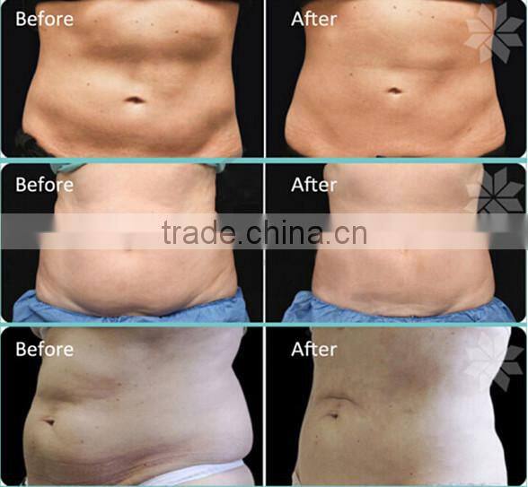 Hot selling ! ! ! good feedback body slimmer