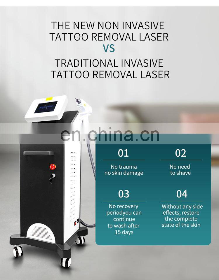 Single Handle Non-invasive Tattoo Removal Laser Machine Q Switch Nd Yag Laser Eyebrow Washing Instrument Pigment Spot Removal