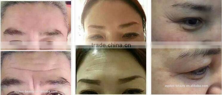 AYJ-X11E-C no needle therapy gun