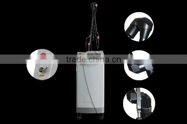 2016 high quality factory price q switch nd yag laser tattoo removal machine