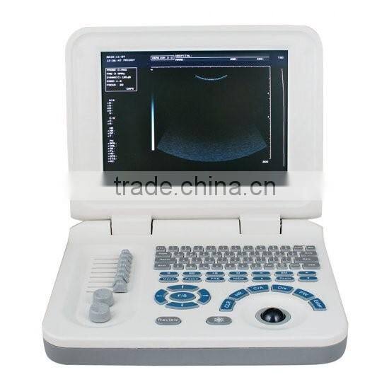 Full Digital Laptop B&W ultrasound system Ultrasound Scanner Ultrasound machine