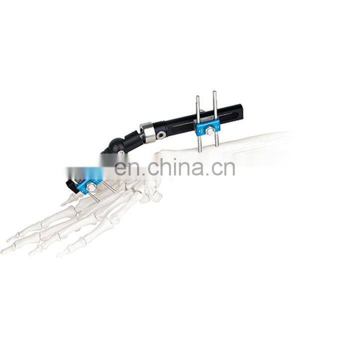 High Quality Wrist Joint External Fixator Orthopedic Surgical Instrument