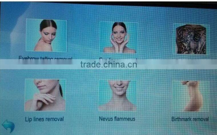 1000,000 shots IPL SHR Elight hair removal machine for fast hair removal