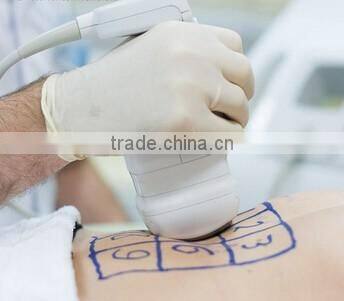 Lose belly fat quickly/ New tech of 13mm depth HIFU reduce fat at once