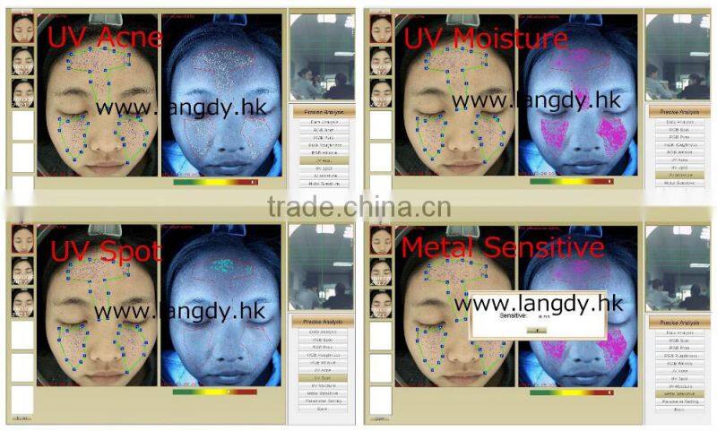 visia skin analysis portable machine with high pixel