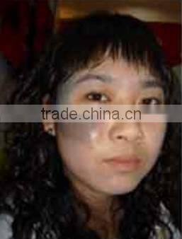 EO Q switch laser KTP Laser nd yag laser machine